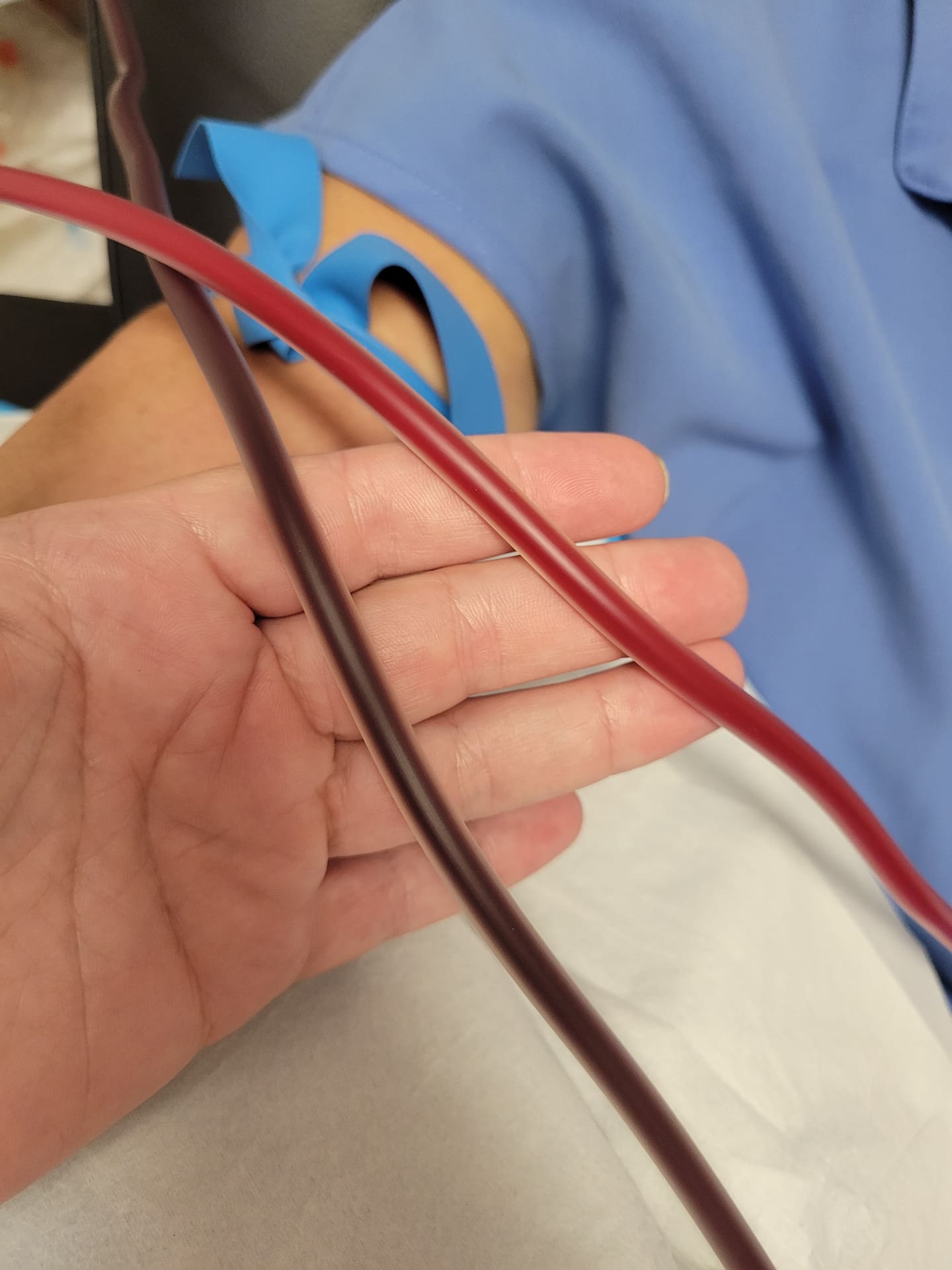 EBOO – Extracorporeal Blood Ozonation & Oxygenation